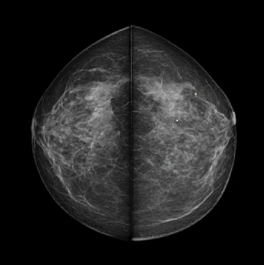 MX-600 · Clinical images 1